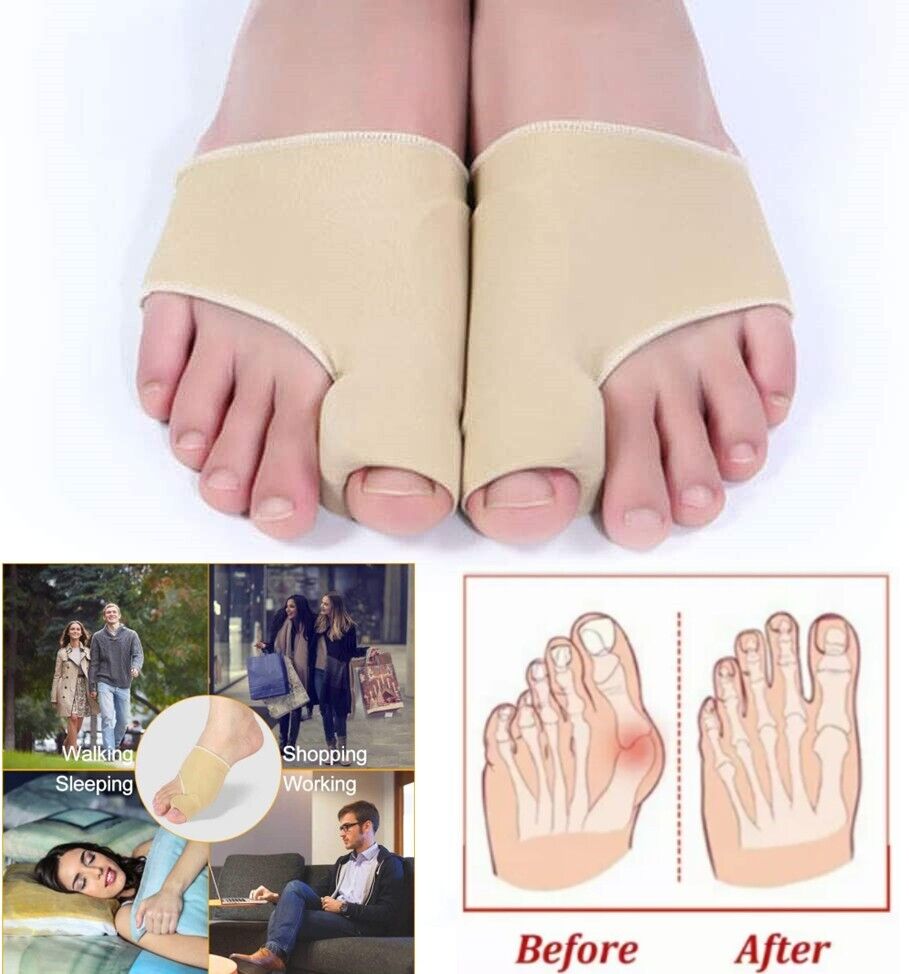 Silicone Bunion Corrector & Toe Separator