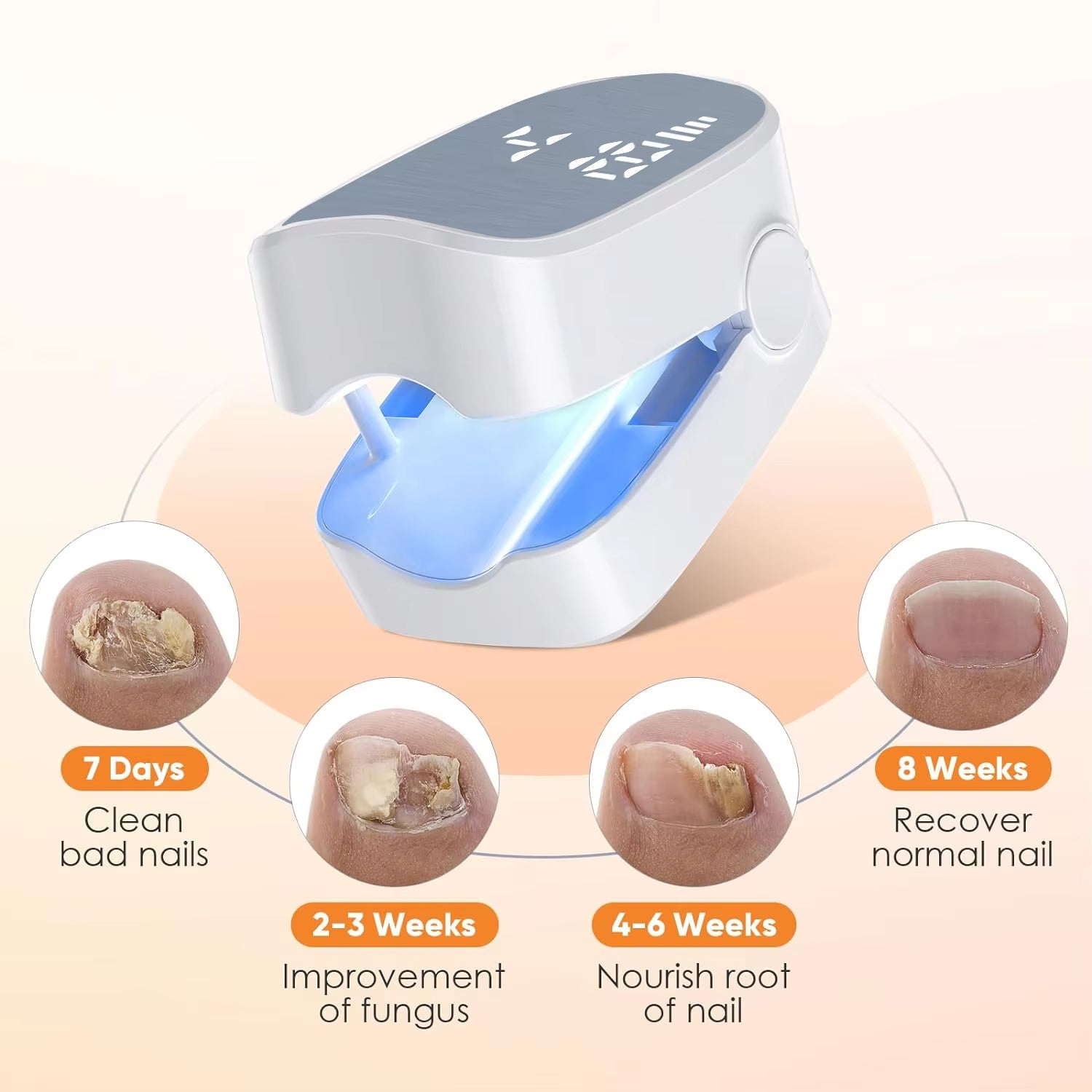 Rechargeable LED Nail Fungus Treatment Device