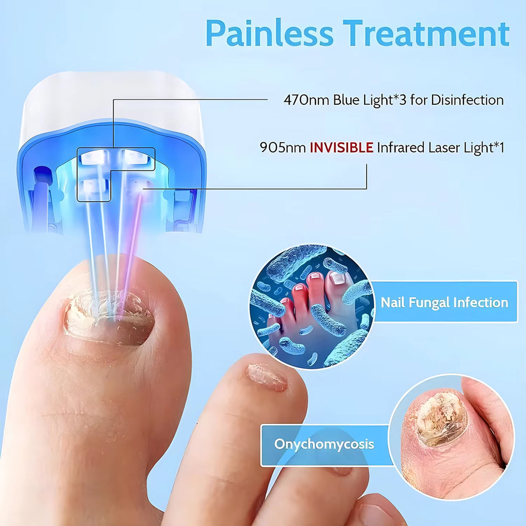 Rechargeable LED Nail Fungus Treatment Device